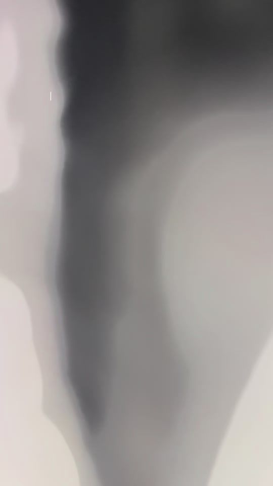 TikTok video thumbnail by glasses.gabs