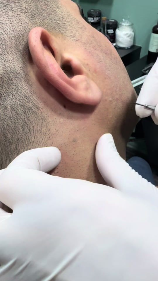 TikTok video thumbnail by berberistanbul1
