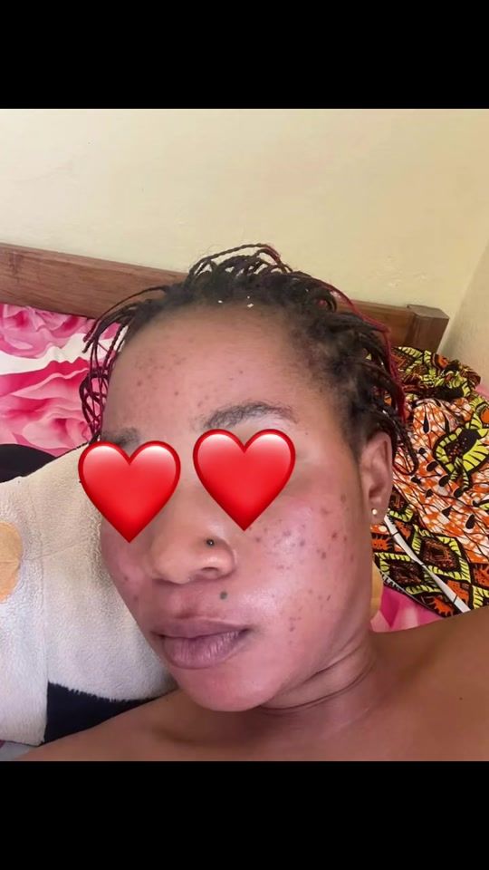 TikTok video thumbnail by rootglowskincare