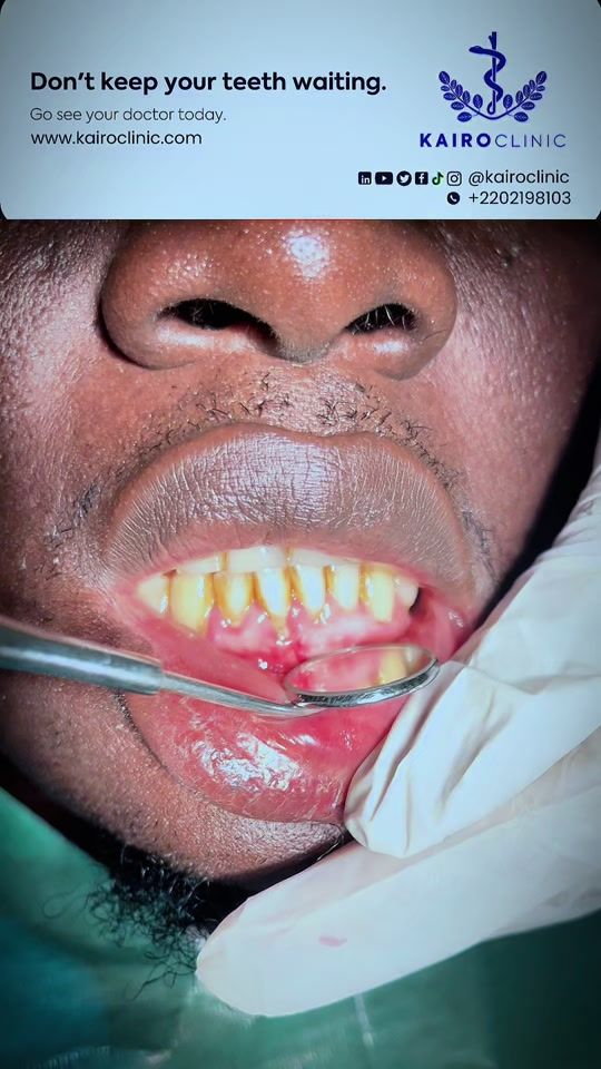 TikTok video thumbnail by kairoclinic