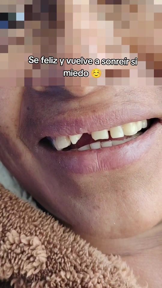 TikTok video thumbnail by pakarysdent