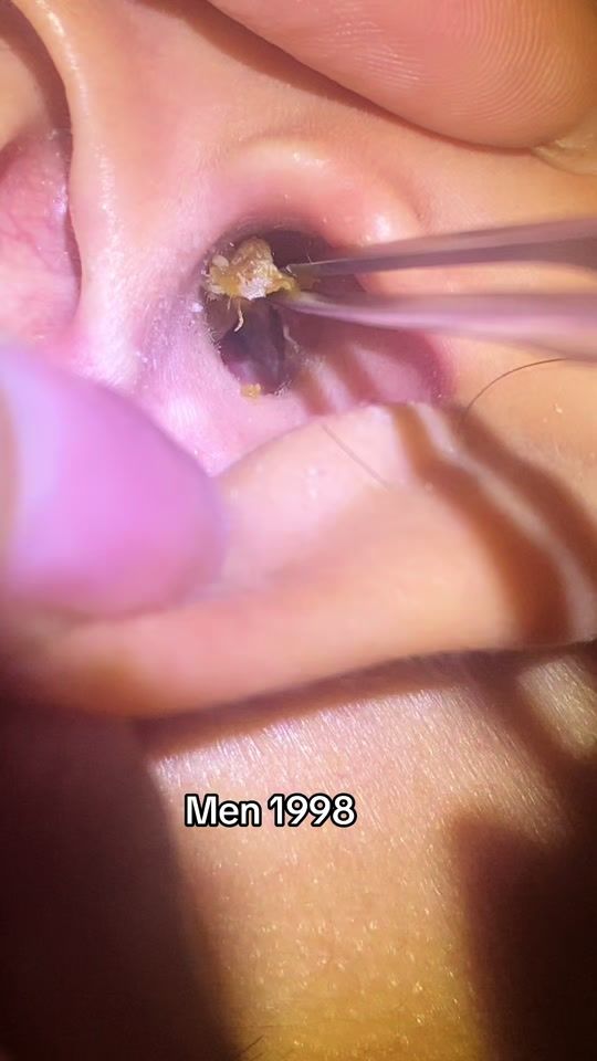 TikTok video thumbnail by 1998_layraytai
