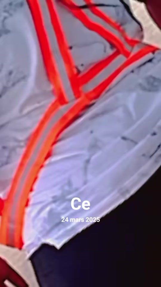 TikTok video thumbnail by leticiadengong
