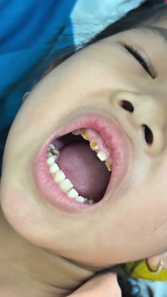 TikTok video thumbnail by nhakhoaduyngoc_5ae