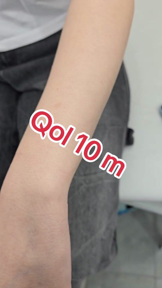 TikTok video thumbnail by nunu_lazer