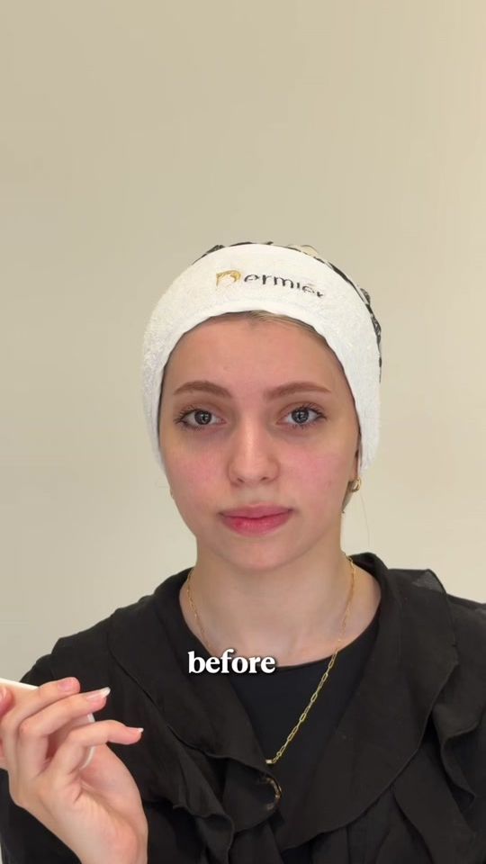 TikTok video thumbnail by dr.randaalnahari