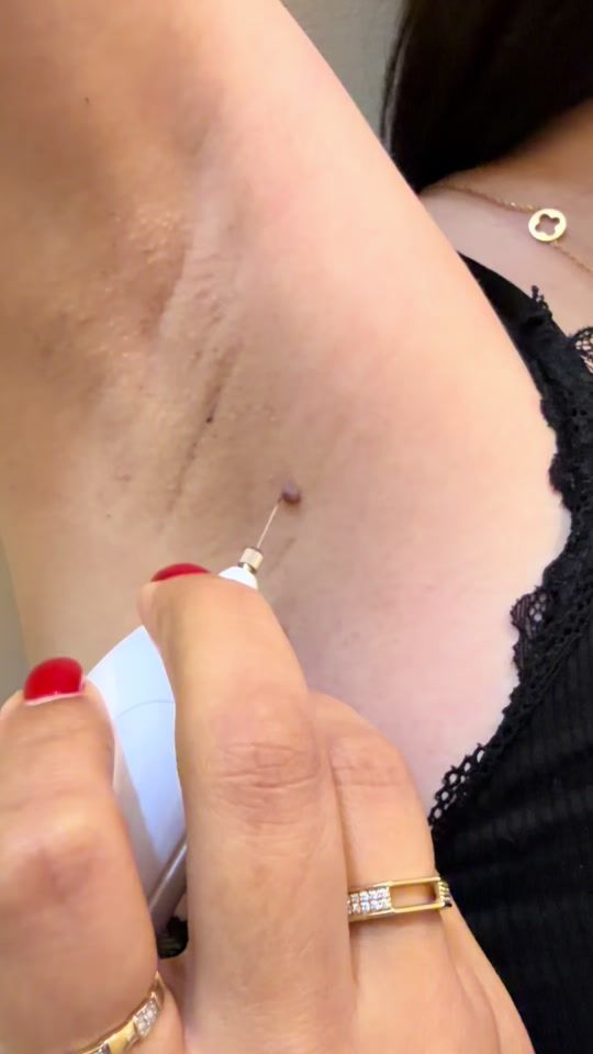 TikTok video thumbnail by lazertattosilme