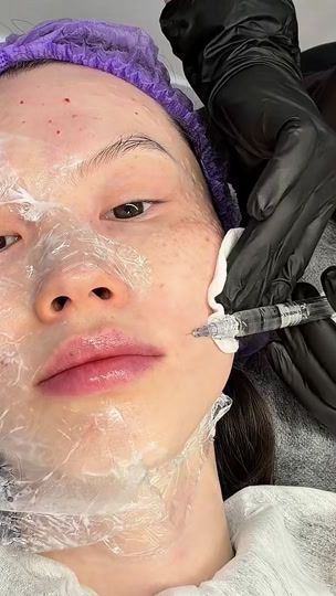 TikTok video thumbnail by amirkamilla