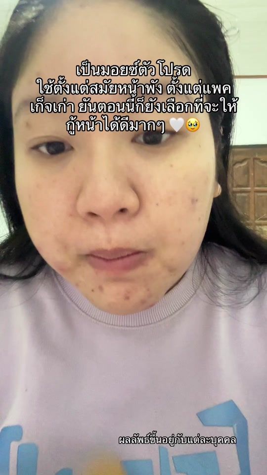 TikTok video thumbnail by noonuu0002