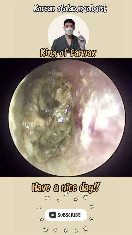 TikTok video thumbnail by king_of_earwax
