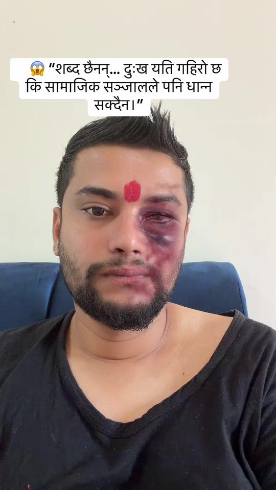 TikTok video thumbnail by bibektechnicalservicellc