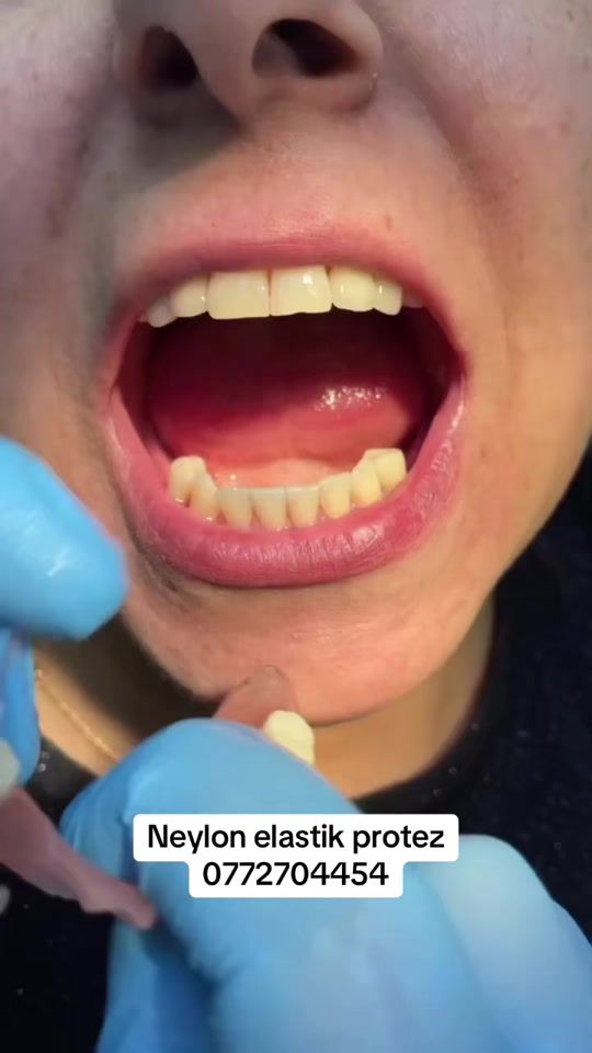 TikTok video thumbnail by dr_talehhasanzade