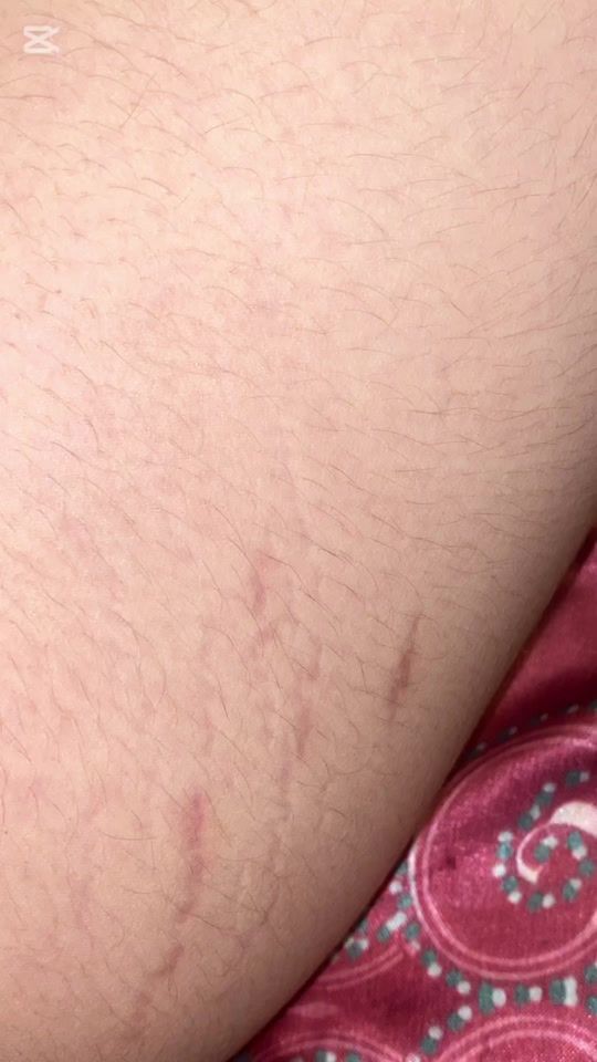 TikTok video thumbnail by skincarehour2