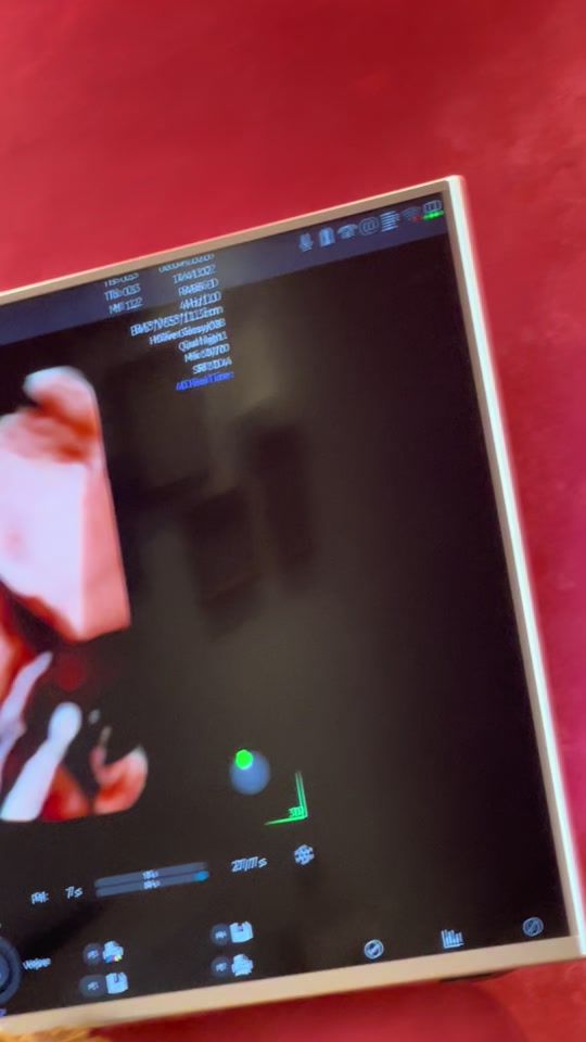 TikTok video thumbnail by algertarexha