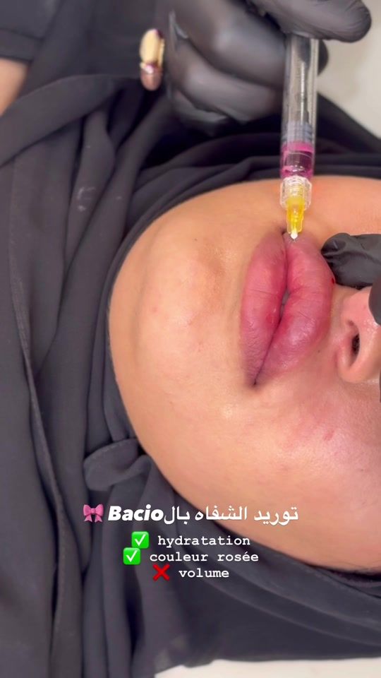 TikTok video thumbnail by dr.imene.djenad
