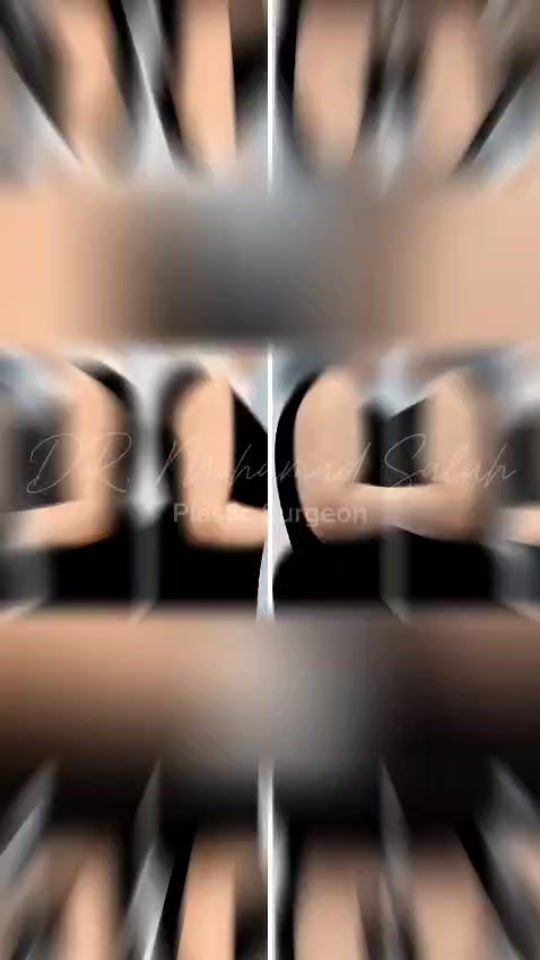 TikTok video thumbnail by doctormosalah11