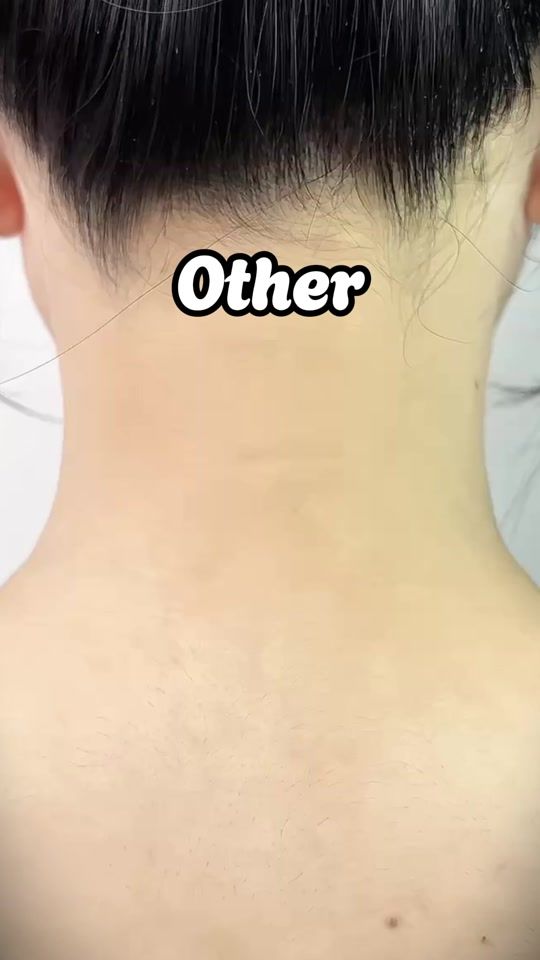 TikTok video thumbnail by pinkflash.vn