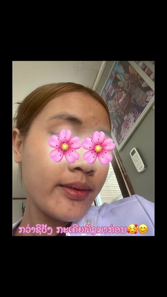 TikTok video thumbnail by larnoy1182