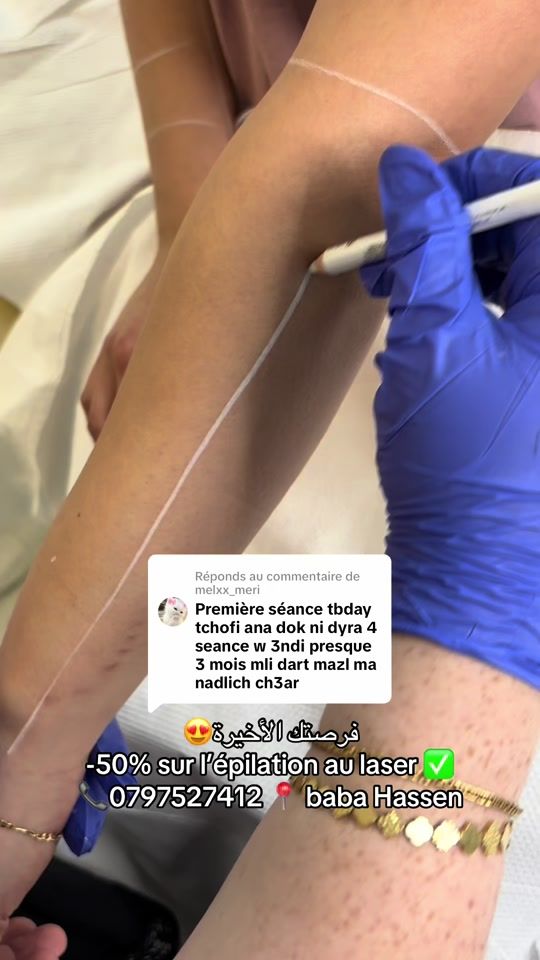 TikTok video thumbnail by dr.imene.djenad