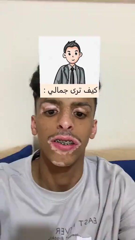 TikTok video thumbnail by q.17