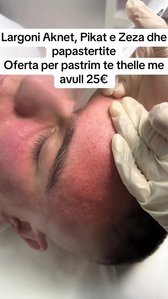 TikTok video thumbnail by omniaesthetic__
