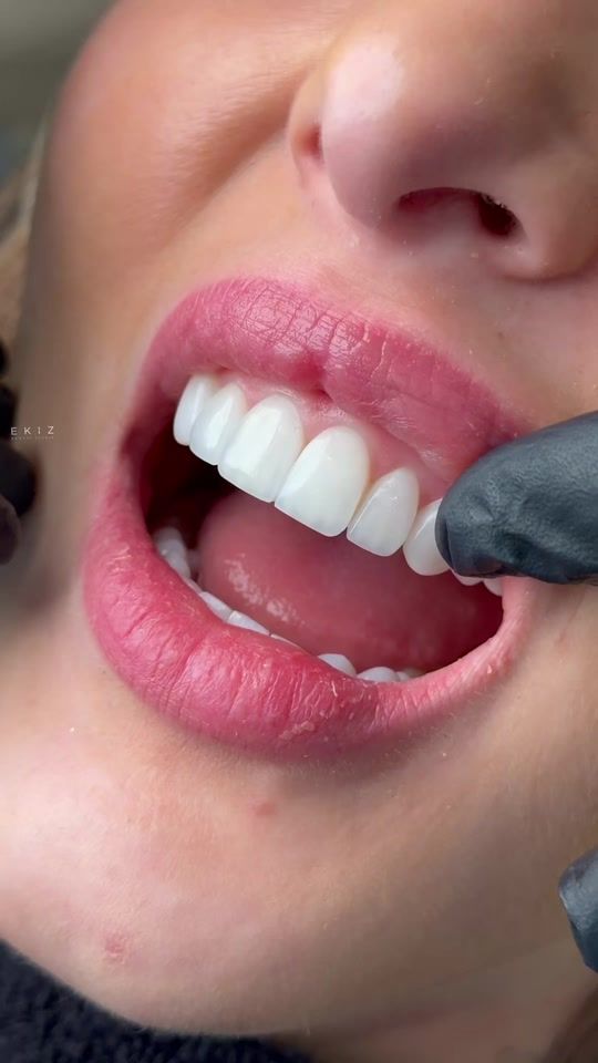 TikTok video thumbnail by oekiz