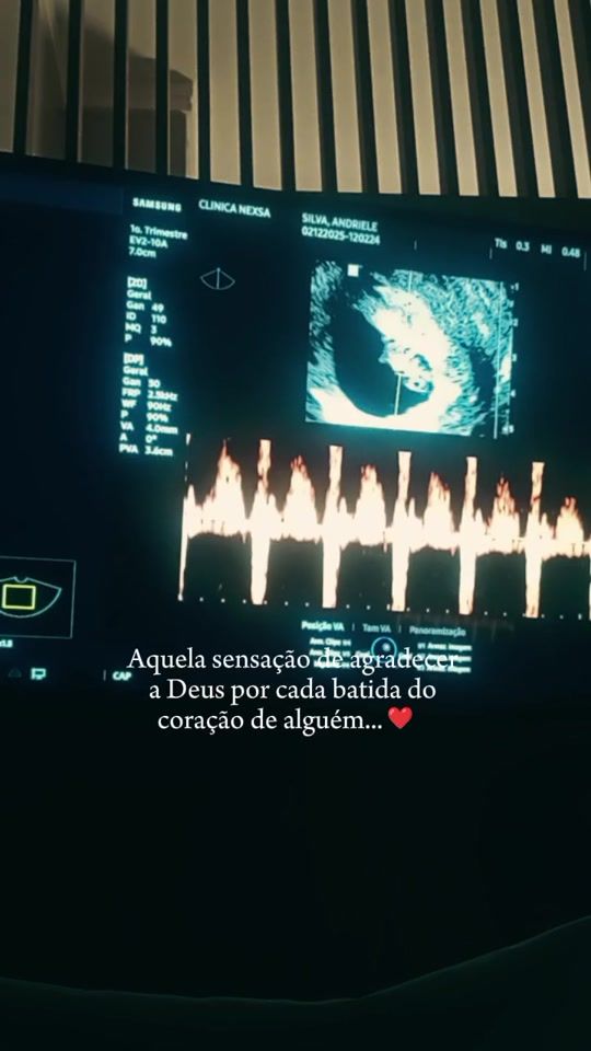 TikTok video thumbnail by negah.da.silva