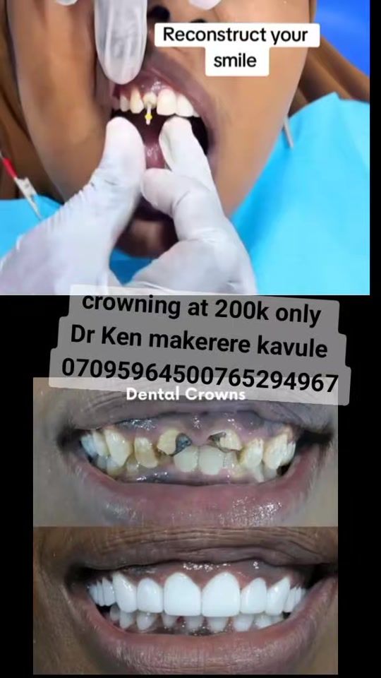 TikTok video thumbnail by kenny25dr