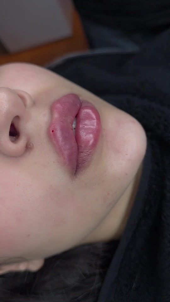 TikTok video thumbnail by dr.laracheaito