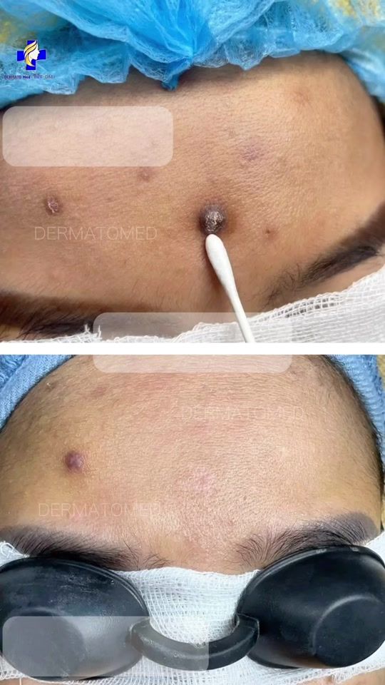 TikTok video thumbnail by dermato_med