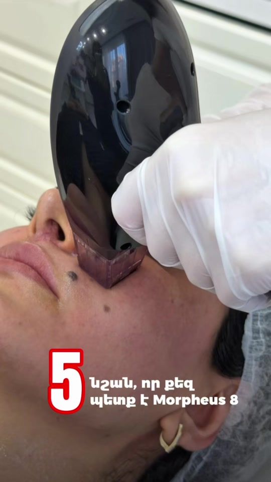TikTok video thumbnail by dr.romanika
