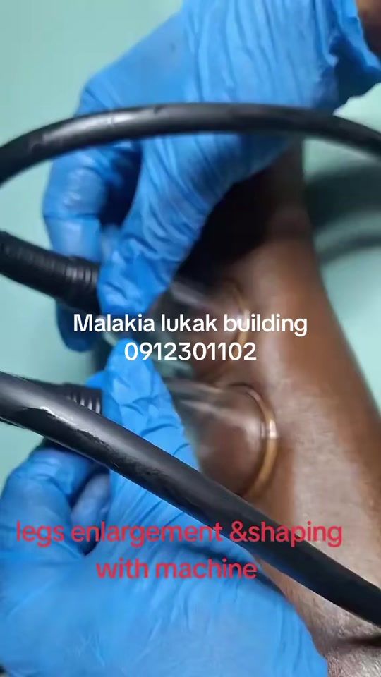 TikTok video thumbnail by dr..mayada.dermab