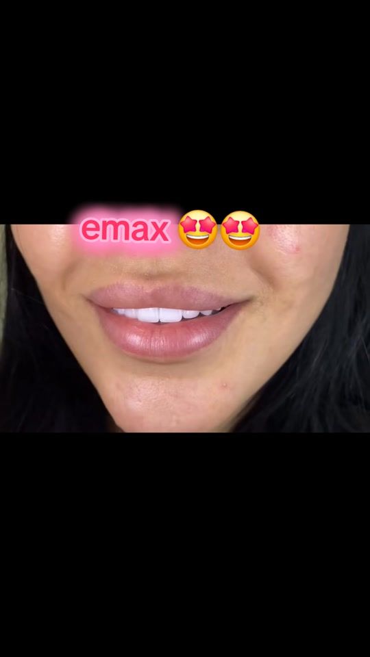 TikTok video thumbnail by dental.stu.dio