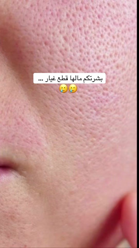 TikTok video thumbnail by care_kas_