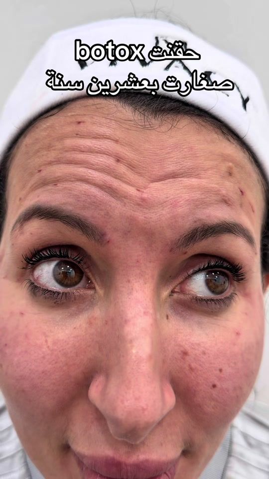 TikTok video thumbnail by docteur_zenati