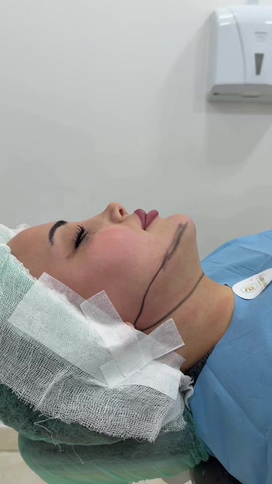 TikTok video thumbnail by dr.ibrahimbeyli