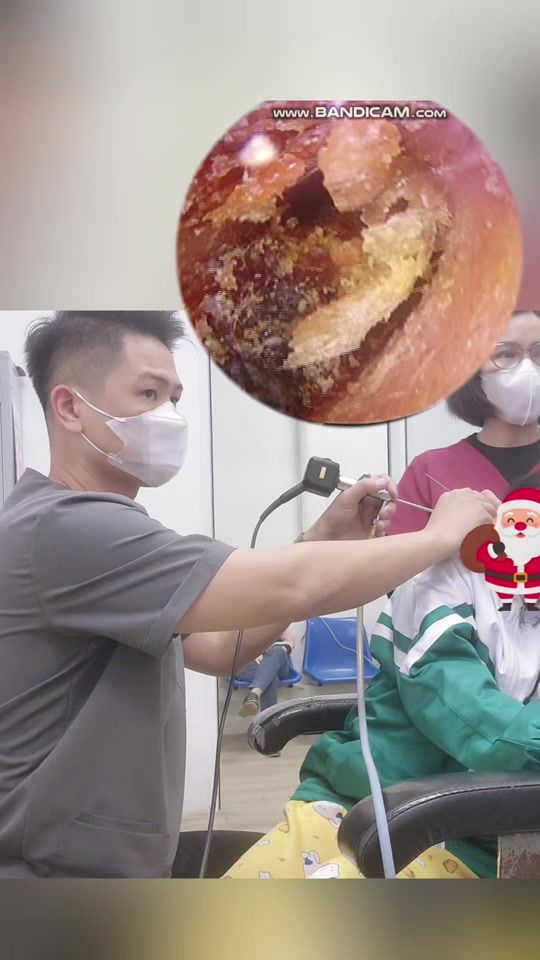 TikTok video thumbnail by bacsidungtran
