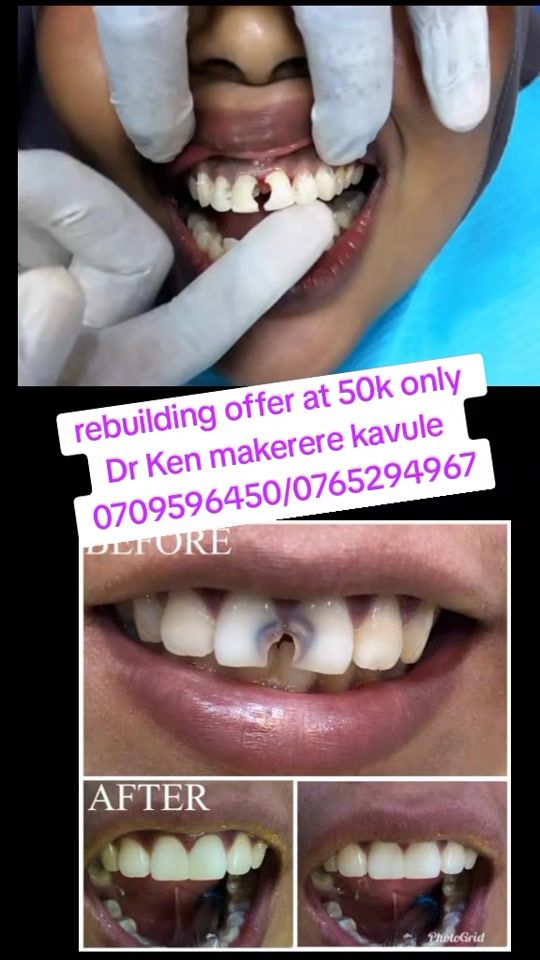 TikTok video thumbnail by kenny25dr