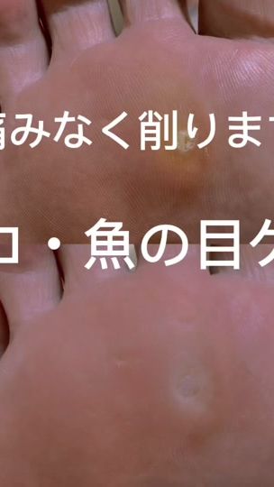 TikTok video thumbnail by foot.maite
