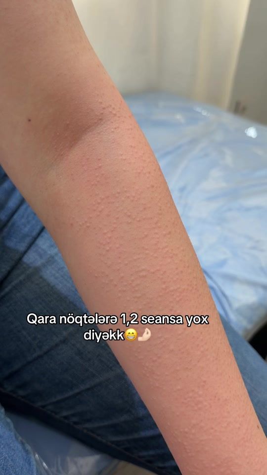 TikTok video thumbnail by laseraydan