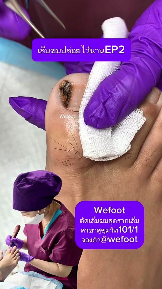 TikTok video thumbnail by wefoot8