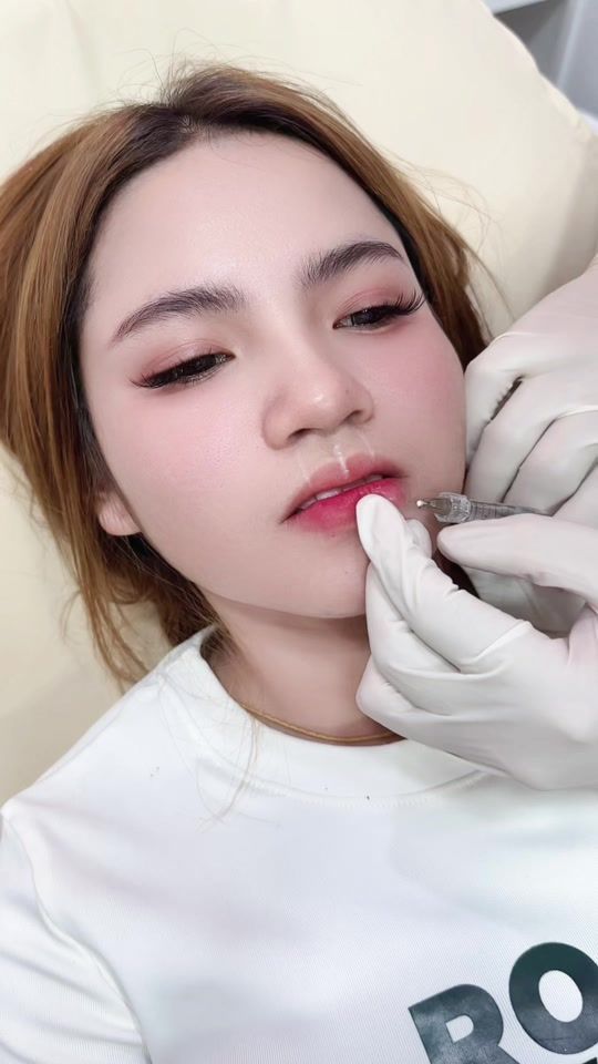 TikTok video thumbnail by natacha.clinic
