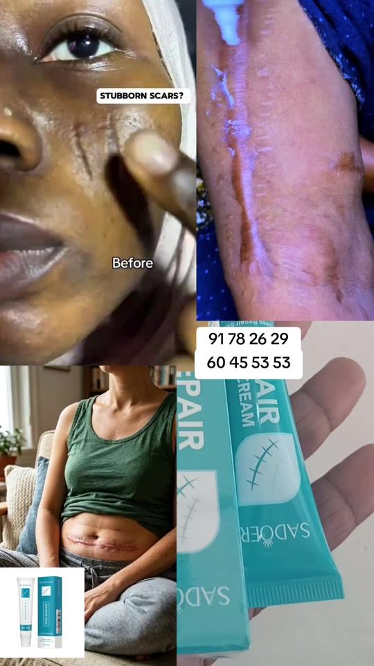 TikTok video thumbnail by ecommerce.birra.a