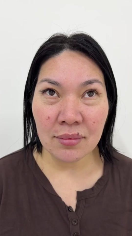 TikTok video thumbnail by dr.dinarabai