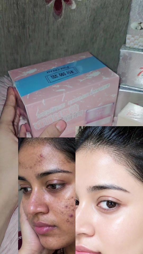 TikTok video thumbnail by zannatpro