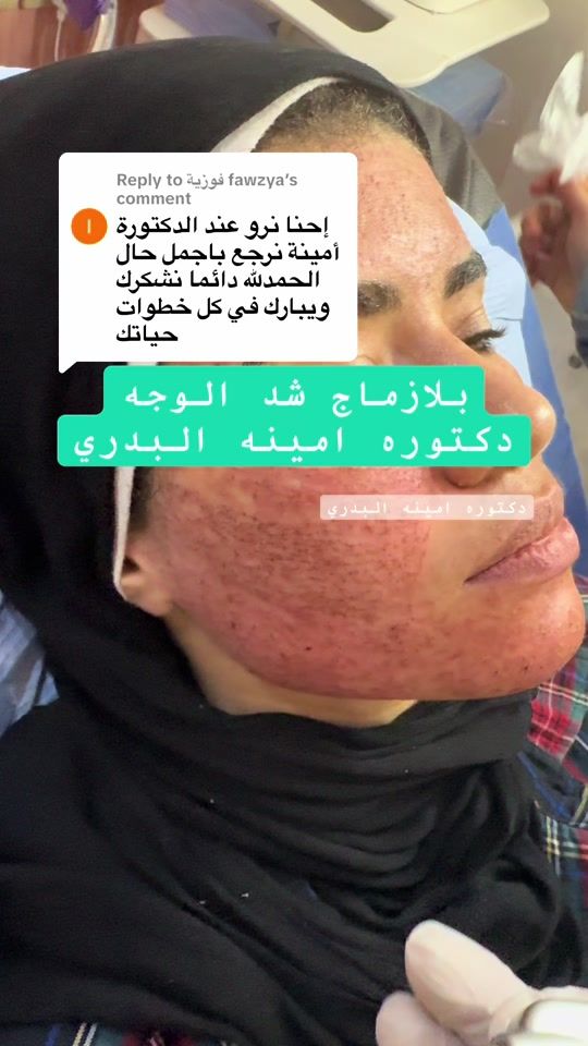 TikTok video thumbnail by dr.amina.albadry