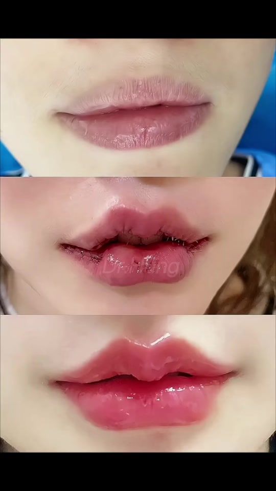 TikTok video thumbnail by dr.hung89