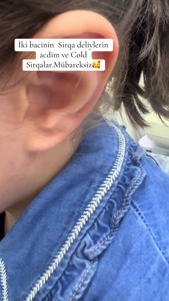 TikTok video thumbnail by dermokosmetoloq_konul