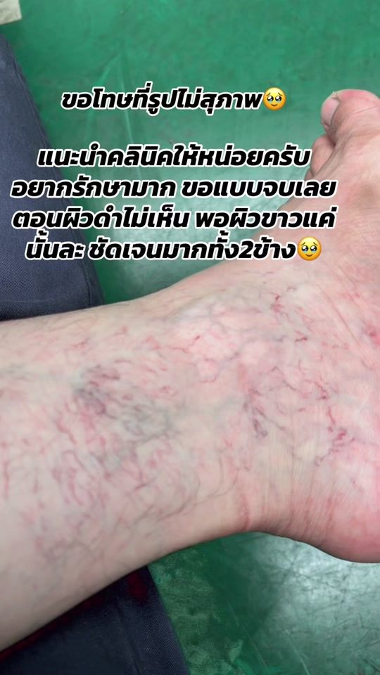 TikTok video thumbnail by pol_sittipol1992