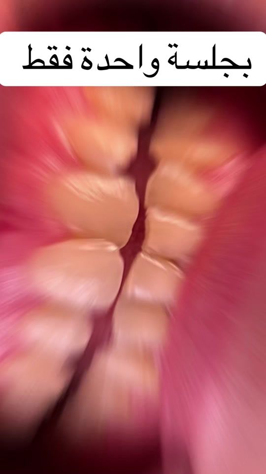 TikTok video thumbnail by dr.houssienalmassri